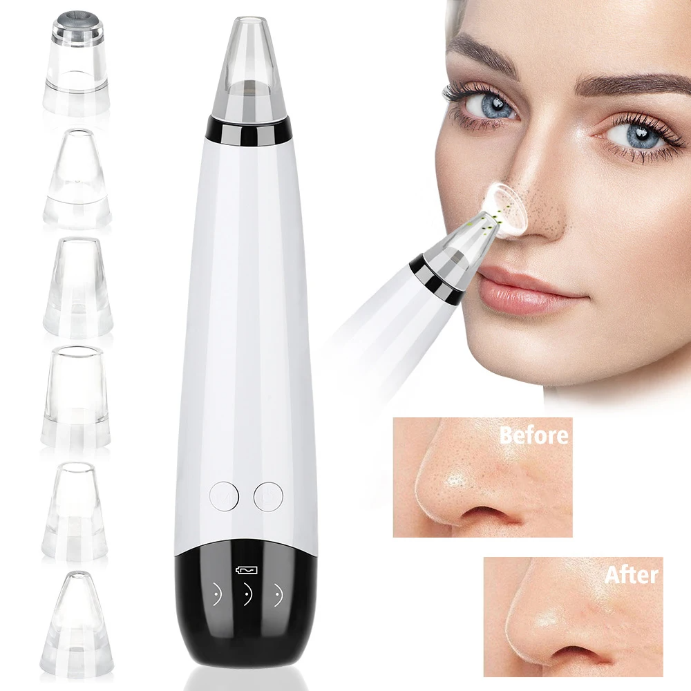 Blackhead Remover Vacuum Acne Pimple Black Spot